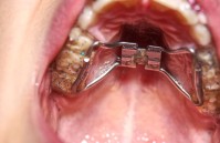 Super Orthodontics  image 3