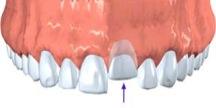 Best Endodontics of Glenview, Ltd. image 6