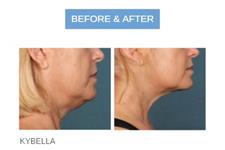 Skin MD Laser & Cosmetic Group image 3