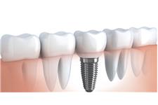 Contemporary Periodontics and Implant Surgery image 2