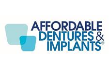Affordable Dentures - Ft. Lauderdale image 3