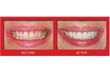 Cosmetic Dentistry Center of NYC image 4