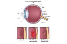 Vision and Eye Medical image 5