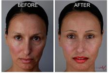 MicroArt Semi Permanent Makeup image 6