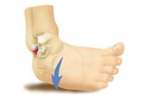 Advanced Foot and Ankle image 2