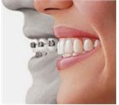 Dental Implants Center of Ashburn image 5