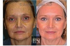 Facial Plastic Surgery Institute image 6