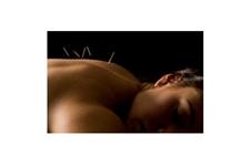 Olo Acupuncture image 7