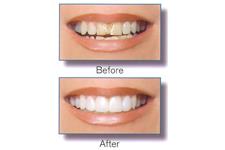 Clear Choice Dental, PLLC image 3
