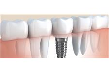 Ridgetop Dental – Cosmetic ,Implants and General Dentistry image 3