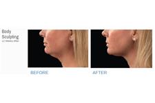 Skin MD Laser & Cosmetic Group image 7