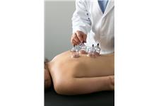 Robertyoungs Acupuncture image 1