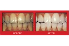 Cosmetic Dentistry Center of NYC image 5