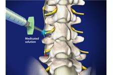 Spine Care of San Antonio, Michael S McKee, MD image 6