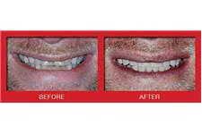 Cosmetic Dentistry Center of NYC image 6