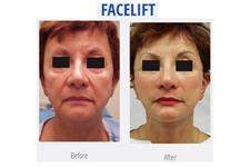 The Langdon Center for Laser & Cosmetic Surgery image 3