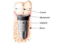 Best Endodontics of Glenview, Ltd. image 5