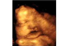 Belly 2 Birth Imaging image 2