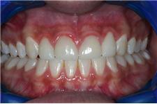 Bauer Dentistry and Orthodontics image 7