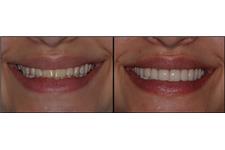 Linhart Dentistry image 6