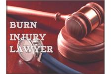 Burn Injury Lawyer image 1