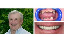 Brueggen Dental Implant Center Houston TX image 4