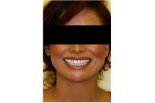 Elegant Smile Dental image 3