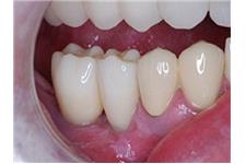 OC Dental Implants image 4