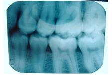 Hanswirth Dentistry image 4