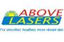 Above Lasers logo