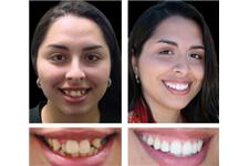 Cosmetic Dental Associates image 7