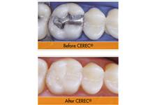Greenfield Family Dentistry, Bruce L. Herr, Jr., DDS image 4