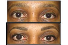 Beautiologist Permanent Makeup and Cosme image 5