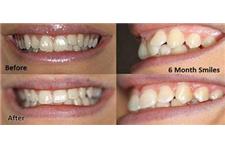 Azalea Dental image 4