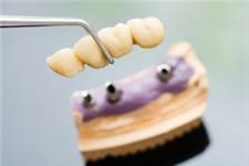 Dental Impressions image 6