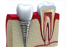 Carepoint Dental image 5