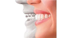 Viechnicki Orthodontics Bethlehem image 7