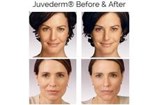 Renova Laser Hair Removal & MedSpa image 3
