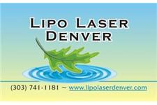 Lipo Laser Denver image 1