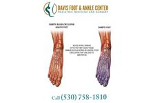 Davis Foot & Ankle Center image 2