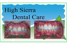 High Sierra Dental Care image 4