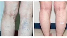 Midwest Vein and Laser image 4