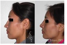 Facial Plastic Surgery Institute image 6