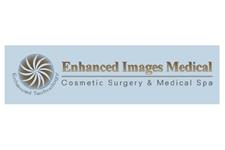 Enhanced Images Medical image 1