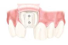 So Cal Dental Implants & Prosthodontics image 3