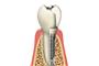 First Class Dental Implants logo