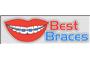 Best Ceramic Braces logo