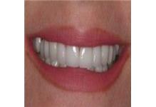 Dental & Dentures Care 24/7 image 3