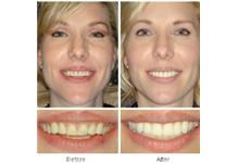 Dental & Dentures Care 24/7 image 2