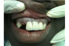 Bronx Dentist NY Dr.Sergey Sandler image 5